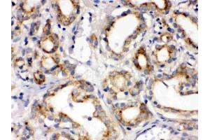 IHC analysis of Frizzled homolog 1 using anti-Frizzled homolog 1 antibody (ABIN3042412). (FZD1 antibody  (C-Term))