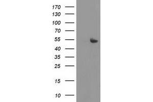 HEK293T cells were transfected with the pCMV6-ENTRY control (Left lane) or pCMV6-ENTRY SHPK (Right lane) cDNA for 48 hrs and lysed. (SHPK antibody)