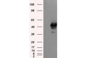 Image no. 2 for anti-SHC (Src Homology 2 Domain Containing) Transforming Protein 1 (SHC1) antibody (ABIN1499995) (SHC1 antibody)