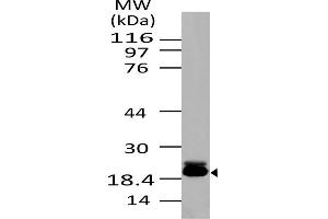 Image no. 1 for anti-Baculoviral IAP Repeat-Containing 5 (BIRC5) antibody (ABIN5027790) (Survivin antibody)