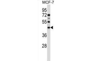 Western Blotting (WB) image for anti-Sphingomyelin Synthase 1 (SGMS1) antibody (ABIN2997403) (Sphingomyelin Synthase 1 antibody)