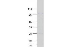 Validation with Western Blot (DCP1A Protein (Myc-DYKDDDDK Tag))