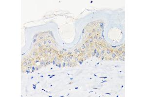 Immunohistochemistry of paraffin-embedded mouse skin using Involucrin Rabbit mAb (ABIN6128025, ABIN6141815, ABIN6141818 and ABIN7101419) at dilution of 1:100 (40x lens). (Involucrin antibody)