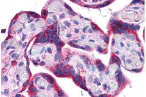 Human Placenta: Formalin-Fixed, Paraffin-Embedded (FFPE) (ATG5 antibody  (C-Term))