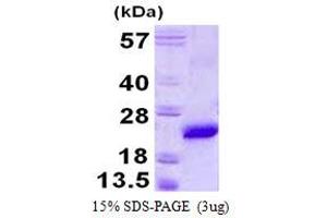 Image no. 1 for Vacuolar Protein Sorting 29 (VPS29) protein (His tag) (ABIN1098238) (VPS29 Protein (His tag))