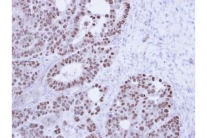 Immunohistochemical staining of paraffin-embedded NCIN87 Xenograft using TAP antibody at a dilution of 1:100