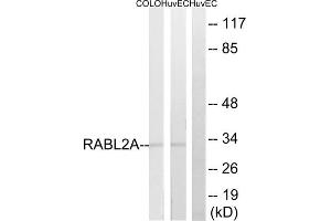 Western blot analysis of extracts from HuvEc, 293 and COLO205 cells, using RABL2A antibody. (RABL2A antibody  (C-Term))