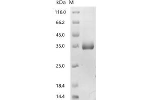 (Tris-Glycine gel) Discontinuous SDS-PAGE (reduced) with 5 % enrichment gel and 15 % separation gel.