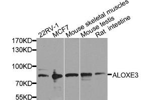 Western blot analysis of extract of various cells, using ALOXE3 antibody.