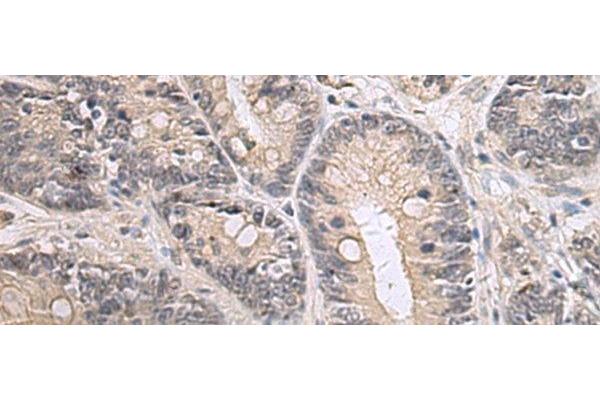 PPM1K antibody