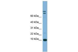 TFF1 antibody used at 1 ug/ml to detect target protein. (TFF1 antibody  (Middle Region))