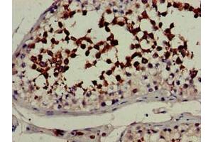 Immunohistochemistry of paraffin-embedded human testis tissue using ABIN7157910 at dilution of 1:100