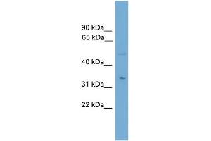 WB Suggested Anti-MGLL Antibody Titration: 0. (MGLL antibody  (N-Term))