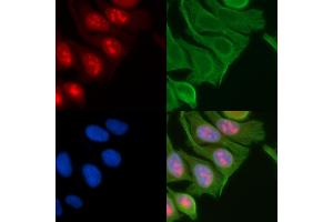 ABIN6257104 and ABIN6274235 staining Hela cells(45 min of heat-shock) by IF/ICC.