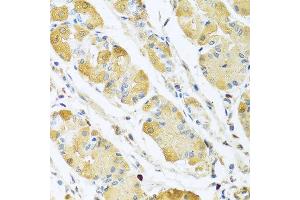 Immunohistochemistry of paraffin-embedded human stomach using C4BPB antibody at dilution of 1:100 (40x lens). (C4BPB antibody)