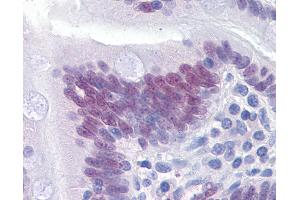 Immunohistochemistry (IHC) image for anti-Caudal Type Homeobox 2 (CDX2) (AA 1-314) antibody (ABIN574224)