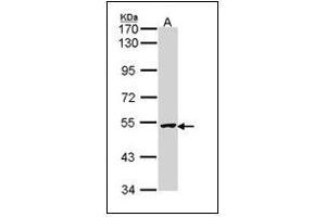 Sample (30 µg of whole cell lysate).