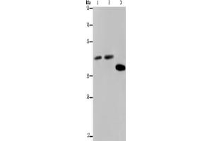 Western Blotting (WB) image for anti-serpin Peptidase Inhibitor, Clade B (Ovalbumin), Member 3 (SERPINB3) antibody (ABIN2423789)