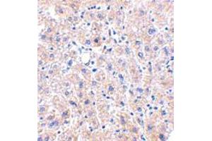 Immunohistochemistry of DRAM in human liver tissue with DRAM polyclonal antibody  at 2. (DRAM antibody  (C-Term))