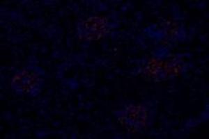 Immunofluorescent analysis of paraformaldehyde-fixed rat kidney using,Slc6a6 (ABIN7075842) at dilution of 1: 600 (TAUT antibody)