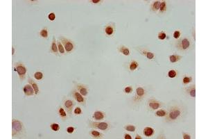 Immunocytochemistry analysis of Hela cells using ABIN7139173 at dilution of 1:100 (HIST1H3A antibody  (acLys23))
