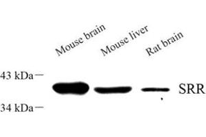 Western blot analysis of srr (ABIN7075554) at dilution of 1: 500 (SRR antibody)