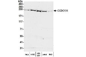 anti-Zinc Finger, C3H1-Type Containing (ZFC3H1) (AA 1939-1989) antibody