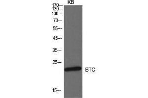 Western Blot (WB) analysis of KB cells using Probetacellulin Polyclonal Antibody. (Betacellulin antibody  (Internal Region))