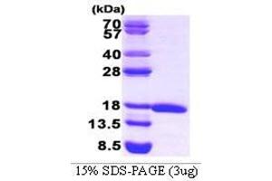 Figure annotation denotes ug of protein loaded and % gel used. (ElF5A (AA 1-154) Protein)