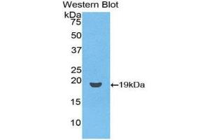 Western Blotting (WB) image for anti-CD59 (CD59) (AA 26-102) antibody (Biotin) (ABIN1174497) (CD59 antibody  (AA 26-102) (Biotin))