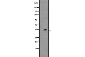 Western blot analysis of OR2T6 expression in ZR-75-1 cell line lysate ,The lane on the left is treated with the antigen-specific peptide. (OR2T6 antibody  (C-Term))