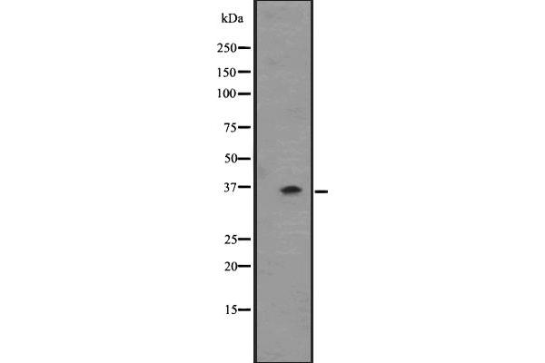 OR2T6 antibody  (C-Term)