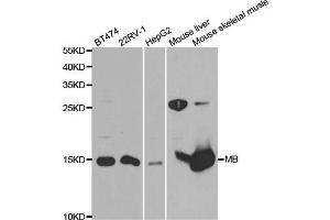 Western Blotting (WB) image for anti-MB antibody (ABIN1876659) (MB antibody)