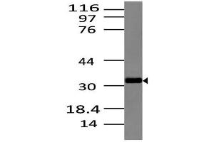 Image no. 1 for anti-C-Type Lectin Domain Family 6, Member A (CLEC6A) (AA 70-230) antibody (ABIN5027146) (C-Type Lectin Domain Family 6, Member A (CLEC6A) (AA 70-230) antibody)