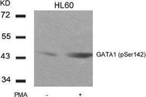 Image no. 3 for anti-GATA Binding Protein 1 (Globin Transcription Factor 1) (GATA1) (pSer142) antibody (ABIN196685) (GATA1 antibody  (pSer142))