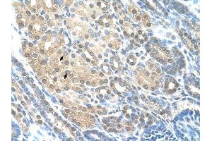 RAD23A antibody was used for immunohistochemistry at a concentration of 4-8 ug/ml to stain Epithelial cells of renal tubule (arrows) in Human Kidney. (RAD23A antibody)