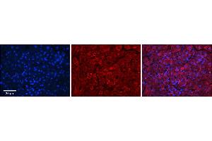 Rabbit Anti-GRHPR Antibody  Catalog Number: ARP48317_P050 Formalin Fixed Paraffin Embedded Tissue: Human Adult Liver  Observed Staining: Cytoplasm in hepatocytes, strong signal, wide tissue distribution Primary Antibody Concentration: 1:100 Secondary Antibody: Donkey anti-Rabbit-Cy3 Secondary Antibody Concentration: 1:200 Magnification: 20X Exposure Time: 0. (GRHPR antibody  (N-Term))