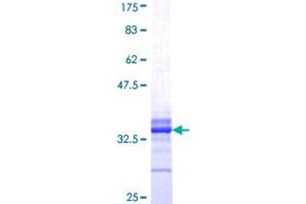 eIF4EBP2 Protein (AA 61-120) (GST tag)