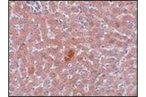 Immunohistochemistry of JMJD1A in rat liver tissue with this product at 5 μg/ml.
