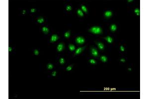 Immunofluorescence of purified MaxPab antibody to DKC1 on HeLa cell.
