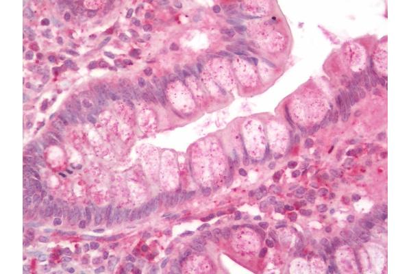 MT1G antibody  (Biotin)