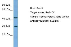 Host: Rabbit Target Name: RAB40C Sample Type: Fetal Muscle lysates Antibody Dilution: 1.