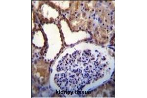 WNK3(PRKWNK3) Antibody (C-term) (ABIN391067 and ABIN2841218) immunohistochemistry analysis in formalin fixed and paraffin embedded human kidney tissue followed by peroxidase conjugation of the secondary antibody and DAB staining. (WNK3 antibody  (C-Term))