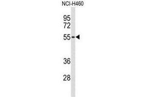 Western blot analysis of ACCN1 Antibody (Center) in NCI-H460 cell line lysates (35 µg/lane). (ACCN1 antibody  (Middle Region))