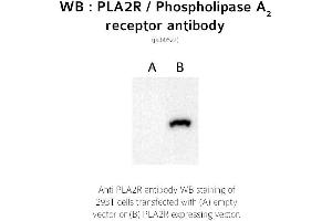 Image no. 1 for anti-phospholipase A2 Receptor 1, 180kDa (PLA2R1) (C-Term) antibody (ABIN347711) (PLA2R1 antibody  (C-Term))