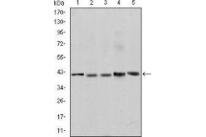 Western blot analysis using c-Rel mouse mAb against Jurkat (1), NIH/3T3 (2), Hela (3), HEK293 (4) and RAJI (5) cell lysate. (c-Rel antibody)