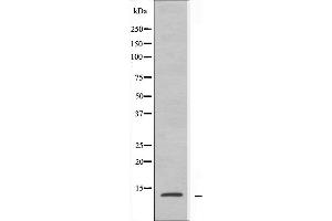 Western blot analysis of extracts from A549 cells using RPL30 antibody. (RPL30 antibody  (C-Term))