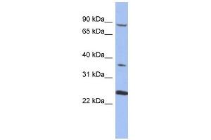 MPP3 antibody used at 1 ug/ml to detect target protein. (MPP3 antibody)