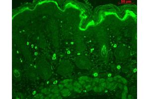 Immunohistochemistry analysis using Rabbit Anti-TNF-R1 Polyclonal Antibody . (TNFRSF1A antibody  (AA 20-43) (PerCP))