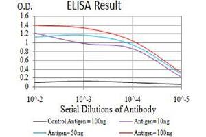 Black line: Control Antigen (100 ng),Purple line: Antigen (10 ng), Blue line: Antigen (50 ng), Red line:Antigen (100 ng)